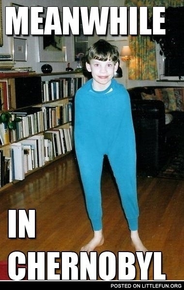 Meanwhile in Chernobyl. Mutant boy.