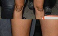 Miley Cyrus knee