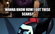 Wanna know how I got these scars?